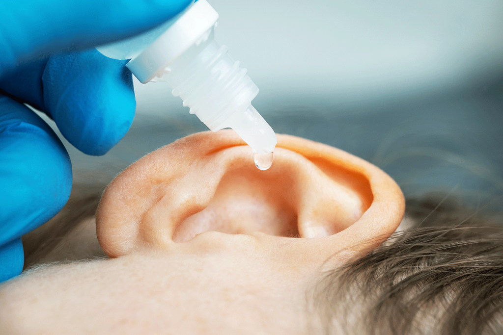 an ear with hydrogen peroxide drops going into it